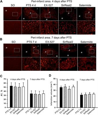 Sirtuins 1 and 2 in the Acute Period After Photothrombotic Stroke: Expression, Localization and Involvement in Apoptosis
